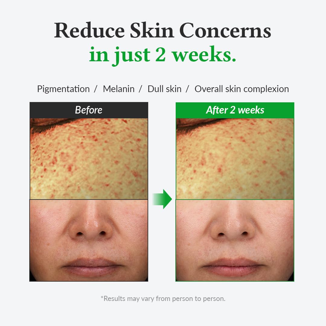 DR.ALTHEA Gentle Vitamin C Serum - 30ml - Imagen 10