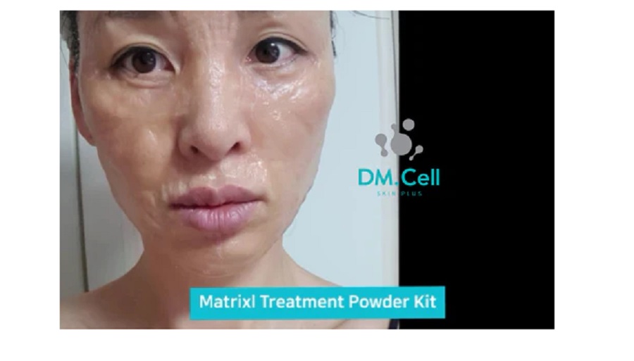 DM.CELL - Matrixl Anti-Wrinkle Powder Kit - 12 Ampollas + Activador - Imagen 7