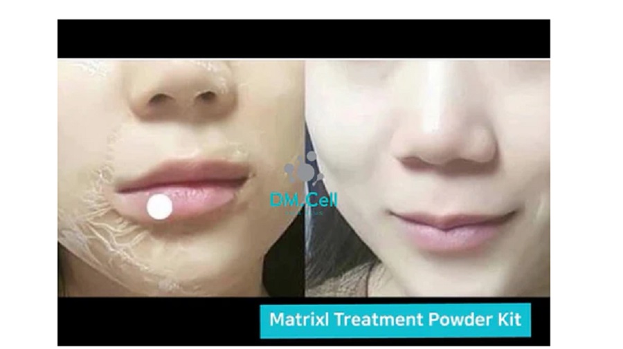 DM.CELL - Matrixl Anti-Wrinkle Powder Kit - 12 Ampollas + Activador - Imagen 8