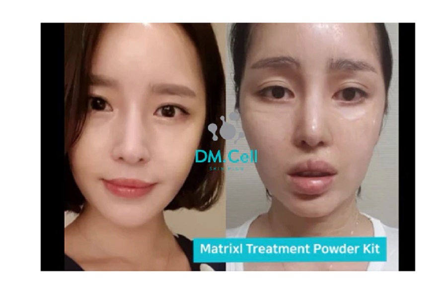 DM.CELL - Matrixl Anti-Wrinkle Powder Kit - 12 Ampollas + Activador - Imagen 6