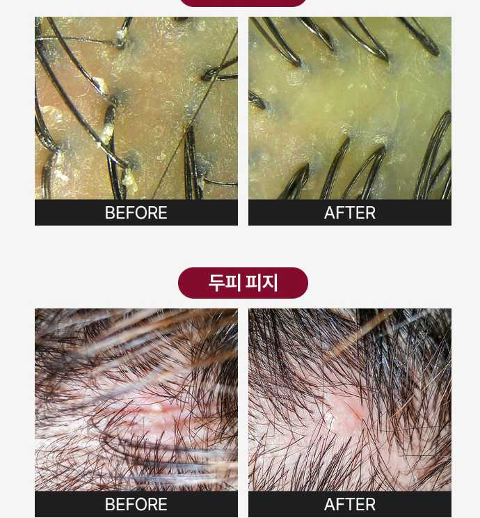 CP-1 - Head Spa Pink Salt Scalp Scaler 230ml - Exfoliante Capilar - Imagen 3