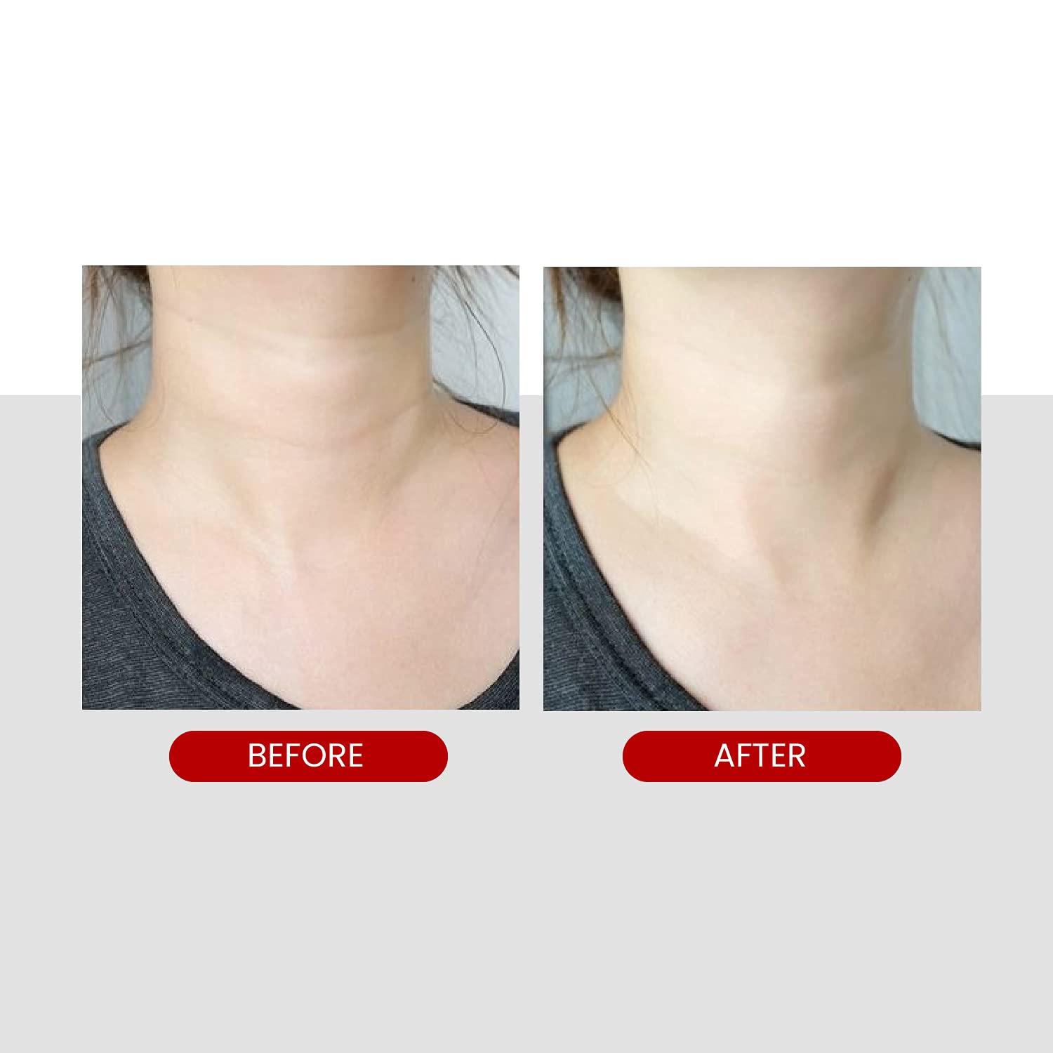 MEDIPEEL - Premium Collagen Naite Thread Neck Cream - 100ml - Imagen 6