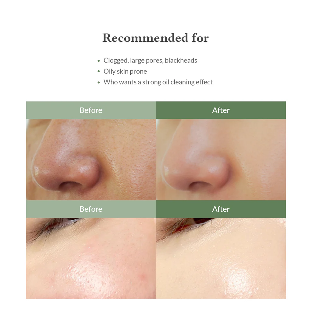 DR.ALTHEA - Quick Step Sebum Cleanser - Ablandador y Removedor de Puntos negros - 100ml - Imagen 6