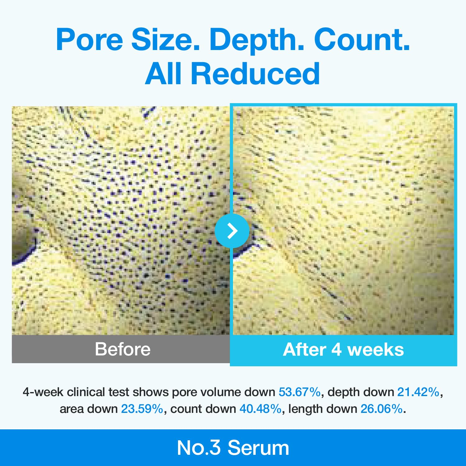 NUMBUZIN - Blue Bio-Retinol Pore Refining Serum - 10 piezas - Imagen 5