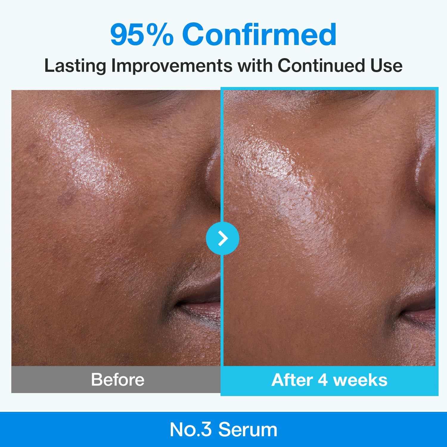 NUMBUZIN - Blue Bio-Retinol Pore Refining Serum - 10 piezas - Imagen 4