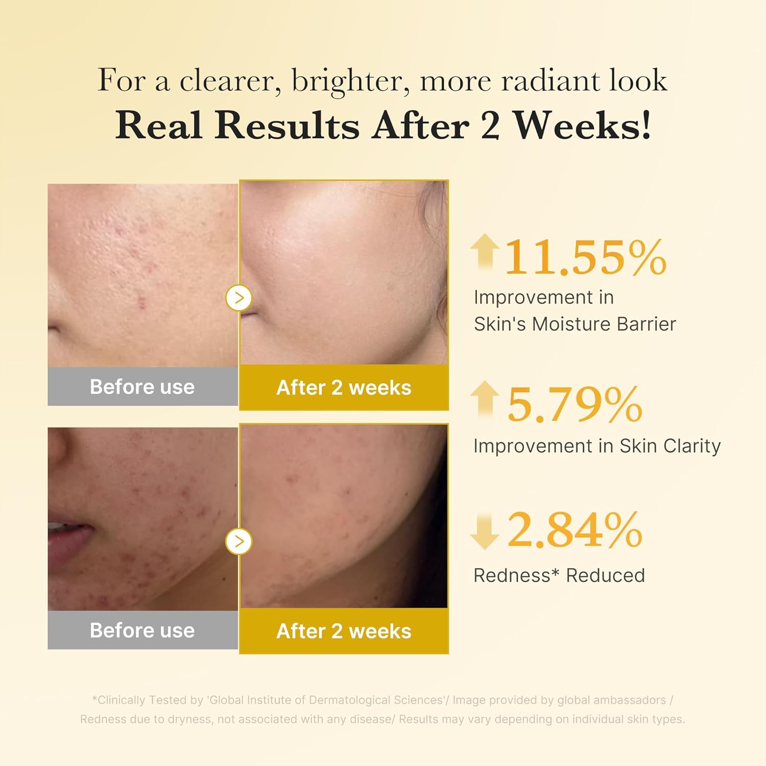 MEDICUBE - Kojic Acid Turmeric Niacinamide - Serum Despigmentante 30ml - Imagen 5