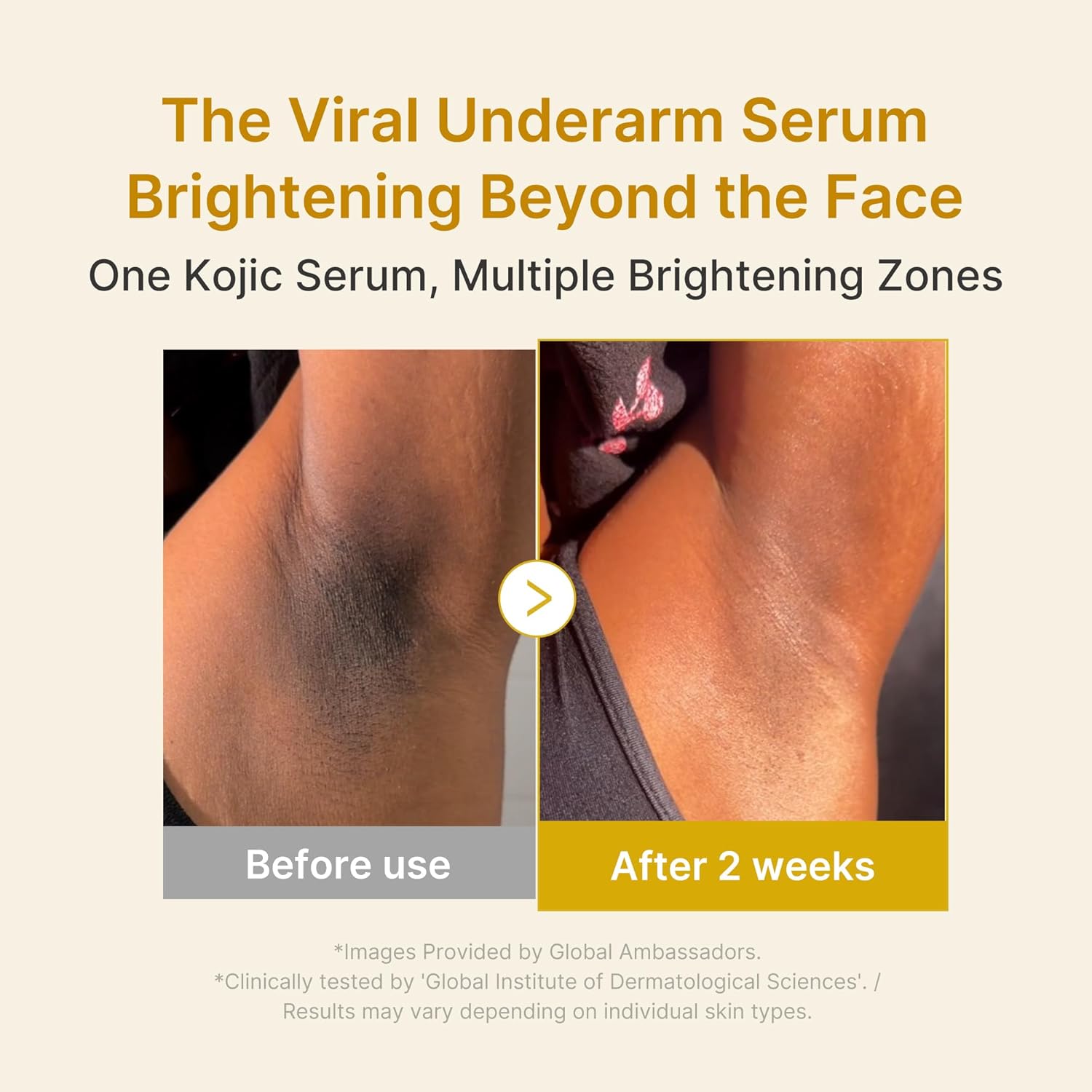 MEDICUBE - Kojic Acid Turmeric Niacinamide - Serum Despigmentante 30ml - Imagen 3