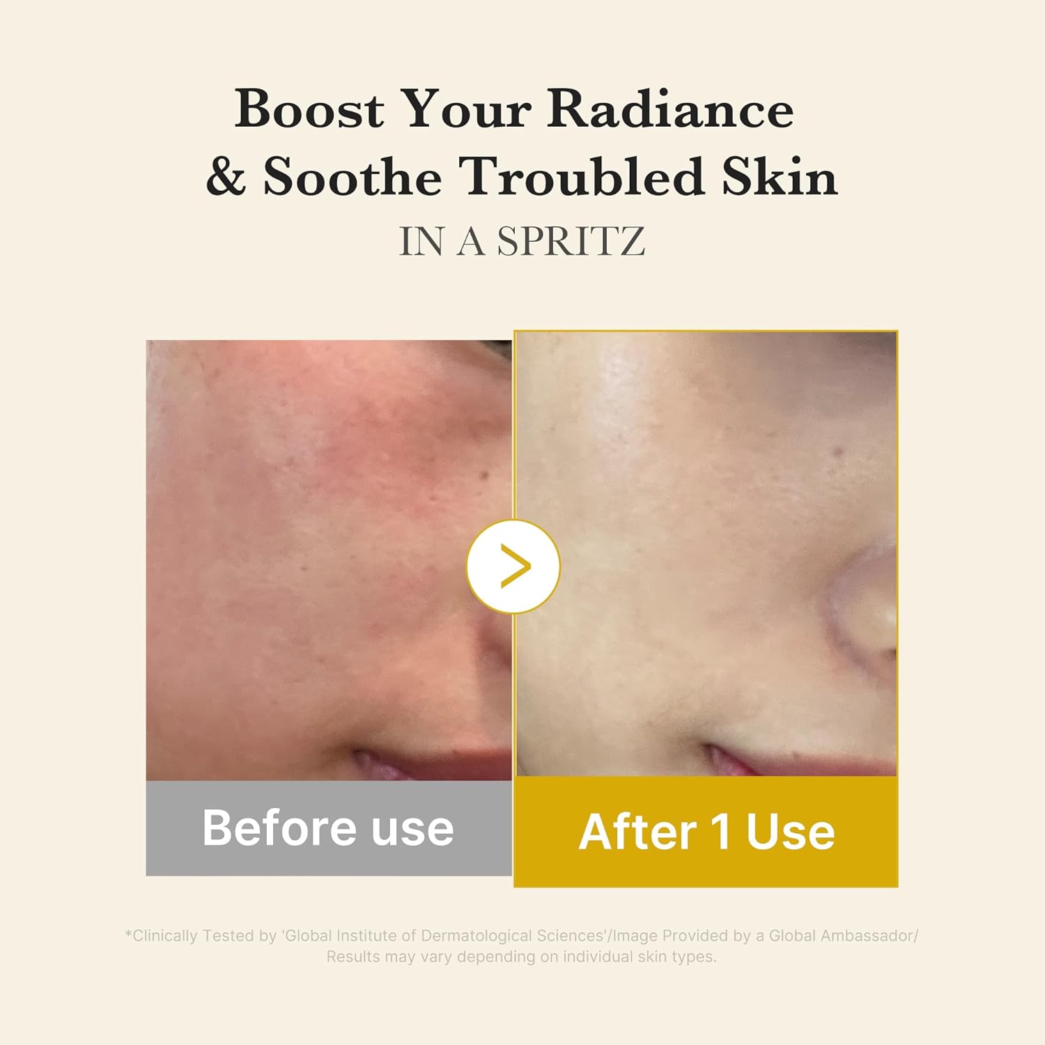 MEDICUBE - Kojic Acid Turmeric Vita Jelly Mist Serum- Bruma Facial 100ml - Imagen 6