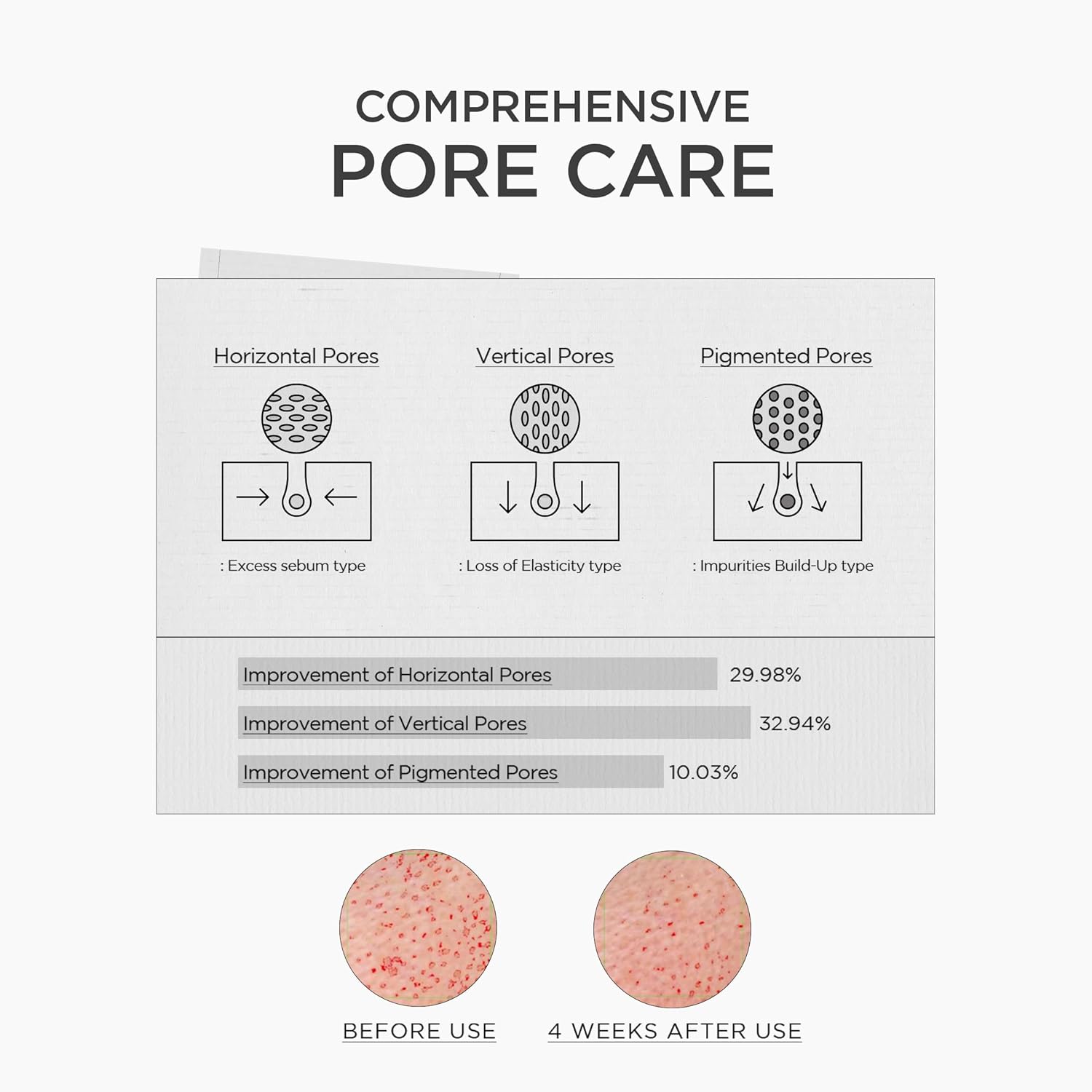SKIN1004 Niacinamide 10 % Shot Ampoule - Mini Talla 9ML - Imagen 3